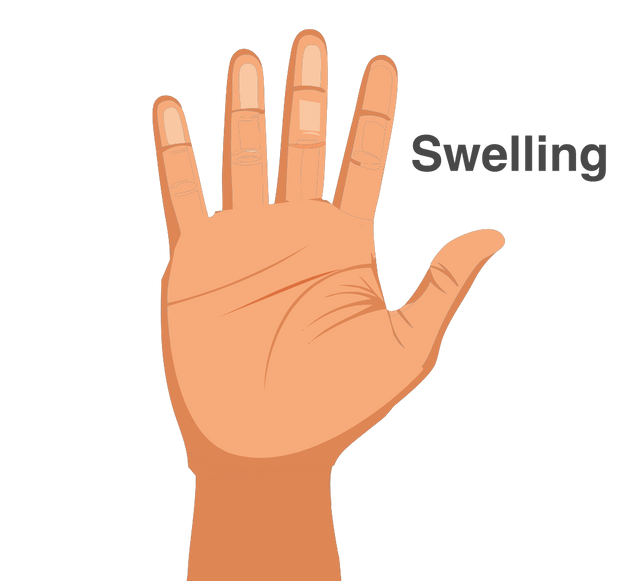 Acute inflammation hallmarks/symptoms