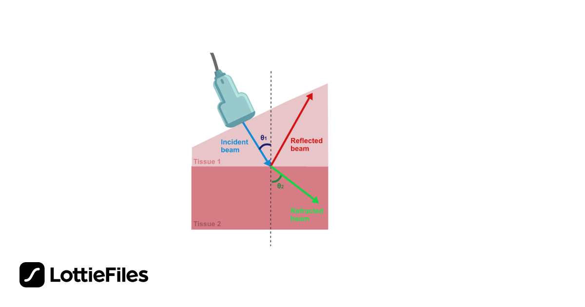Free Ultrasound basics refraction - Interaction with tissue Animation ...