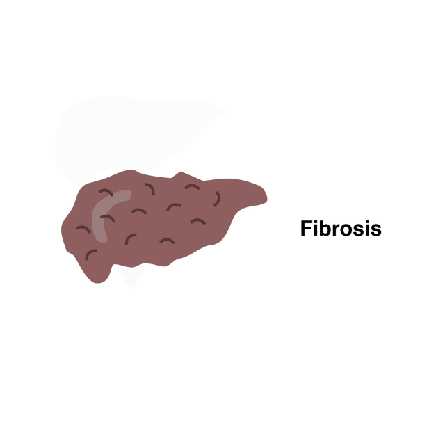 Liver, Hepatocytes and Alpha-1 Antitrypsin