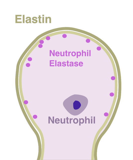 Alpha1 Antitrypsin and Neutrophil elastase