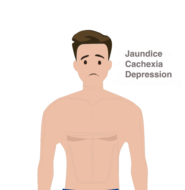 Pancreatic cancer body symptoms