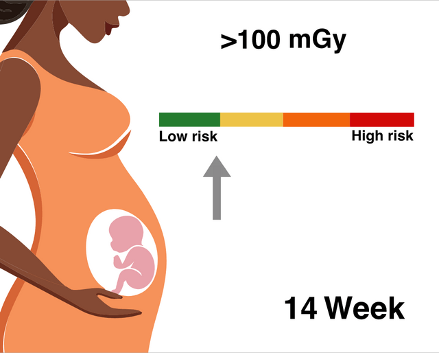 Radiation_pregnancy