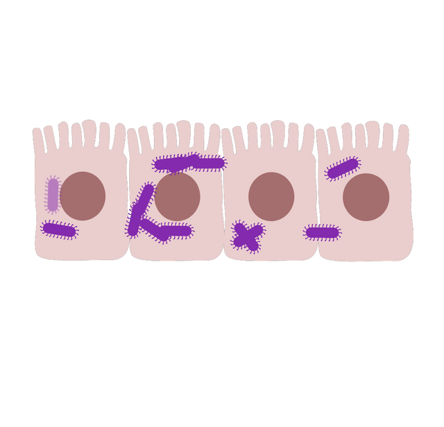 Shigella invading intestine cells