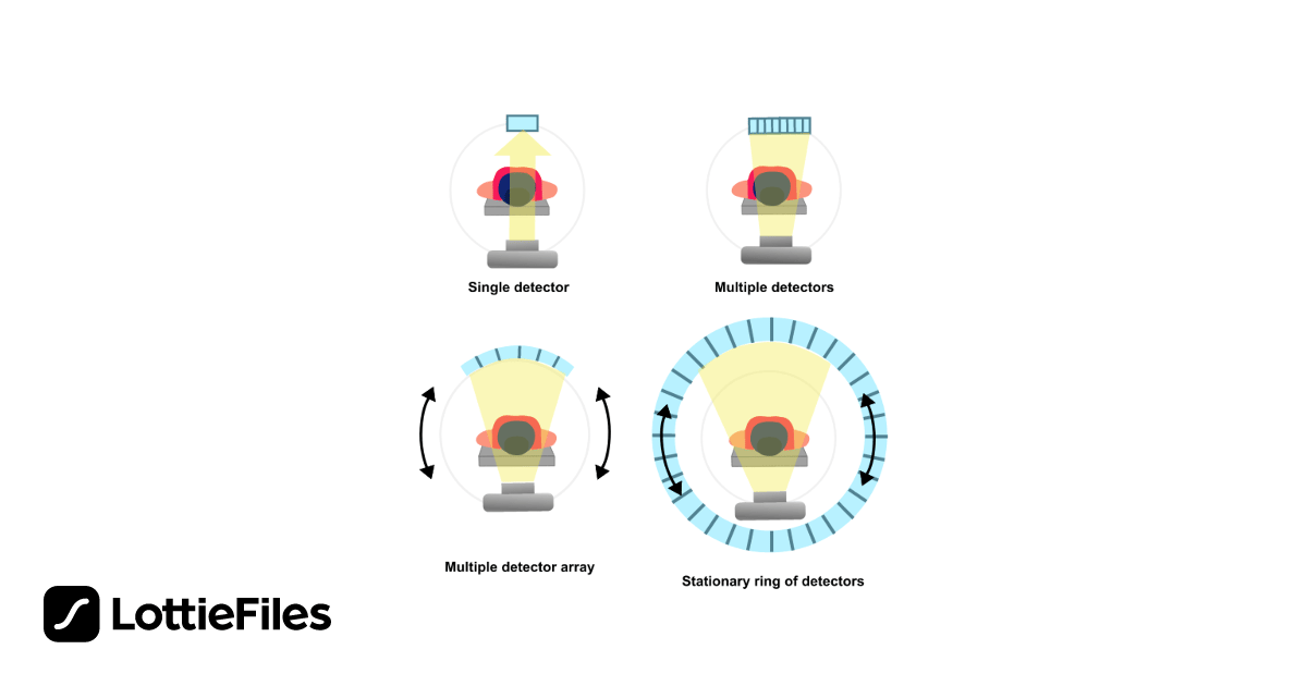 Free CT detectors Animation by Joana Barreira | LottieFiles