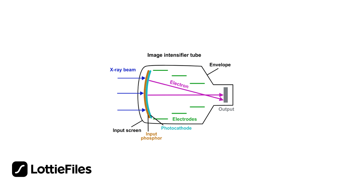 Fluoroscopy Image intensifier system by Joana Barreira LottieFiles