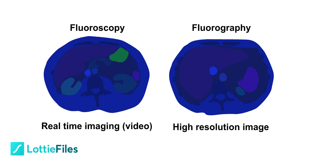 Fluoroscopy vs fluorography by Joana Barreira LottieFiles